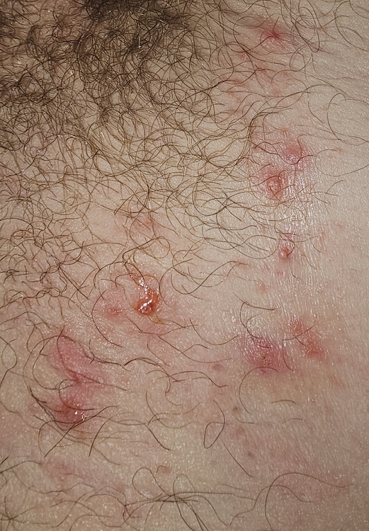 image.thumb.png.f592e143af3fef31fb1fd9d374ca5b84.png