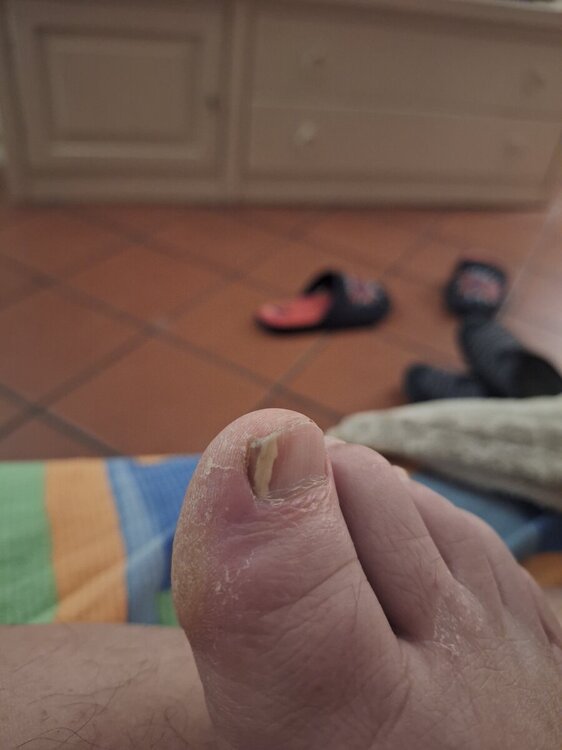 17143390164902734403833023189922.thumb.jpg.e53aaae5b792d0d2f458e7e4a52b33d4.jpg