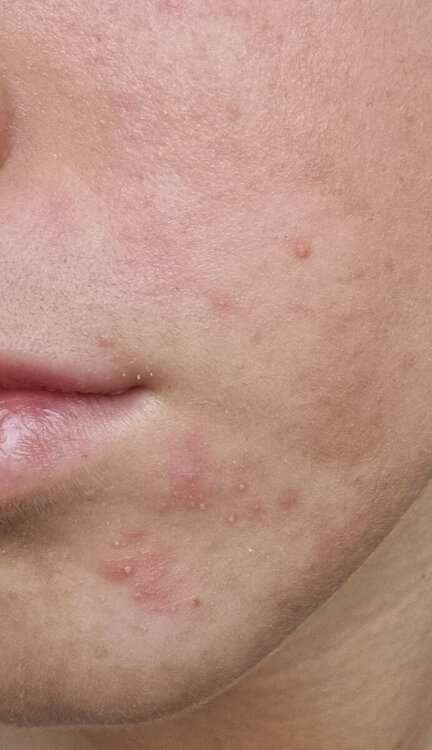 20240418_071536.jpg