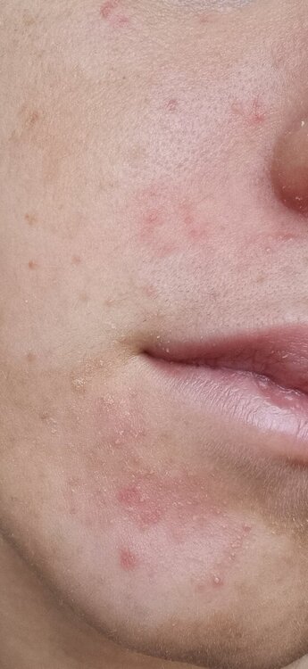 20240418_071544.jpg