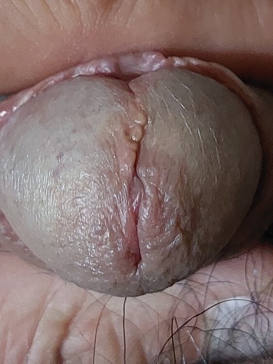 251733107_20240318_205635DERMA.thumb.jpg.4faaa07306d7400ed5b80ac7fcb64be1.jpg