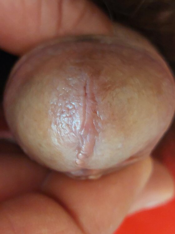 260920132_20240414_085758DERMA.thumb.jpg.8bb4c7a3b8e7dab61f22e6f8497b666e.jpg