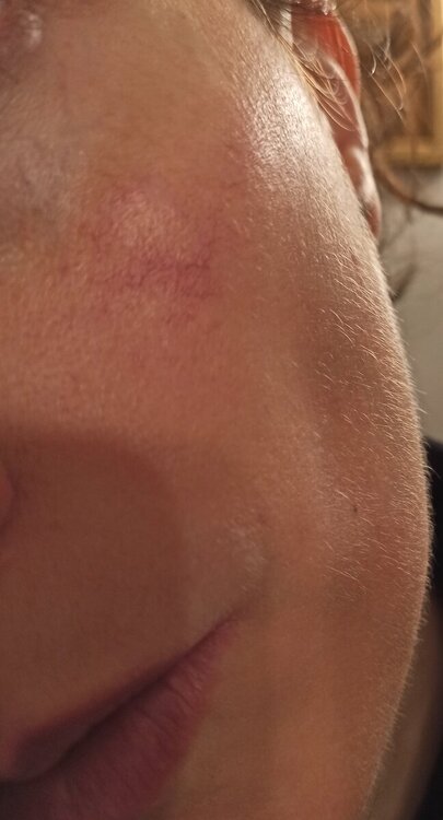 guancia sinistra1.jpg