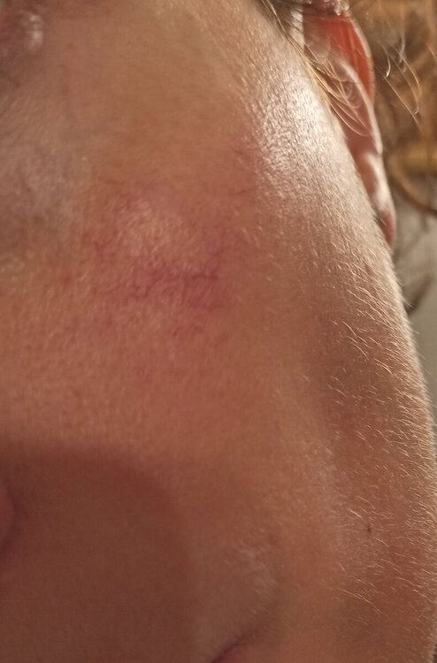 guancia sinistra.jpg