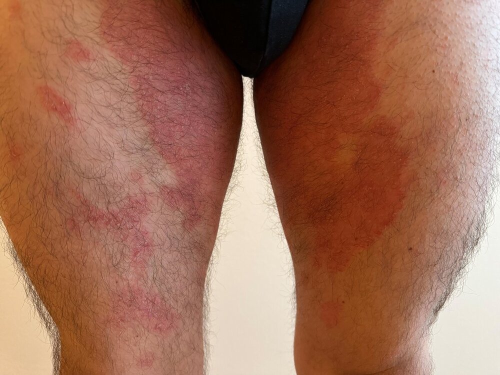 Gambe.jpg