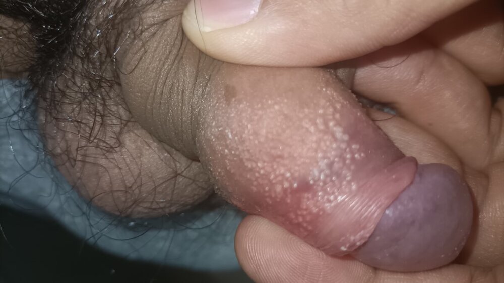 IMG20240412003944.jpg