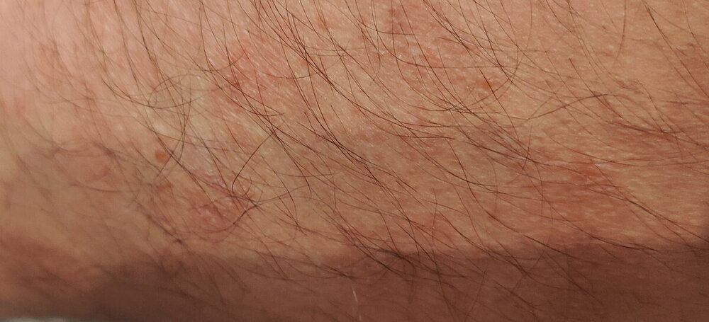 IMG20240426110115.jpg