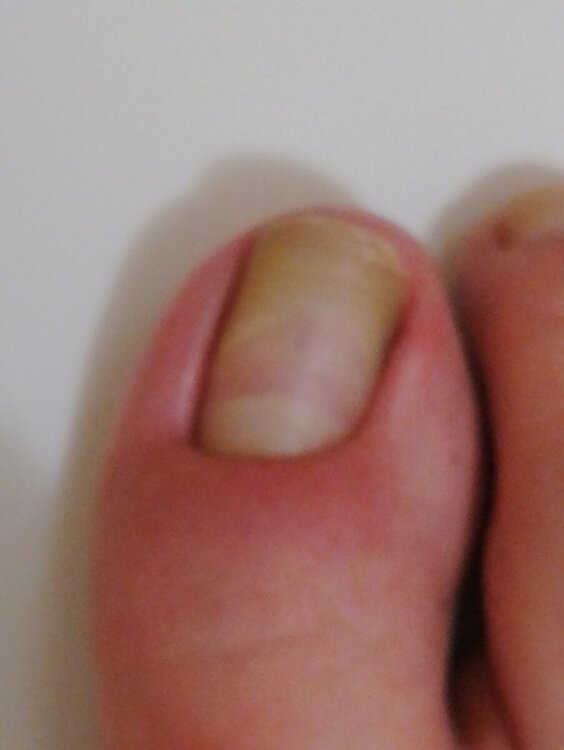 IMG_20240407_200940.jpg