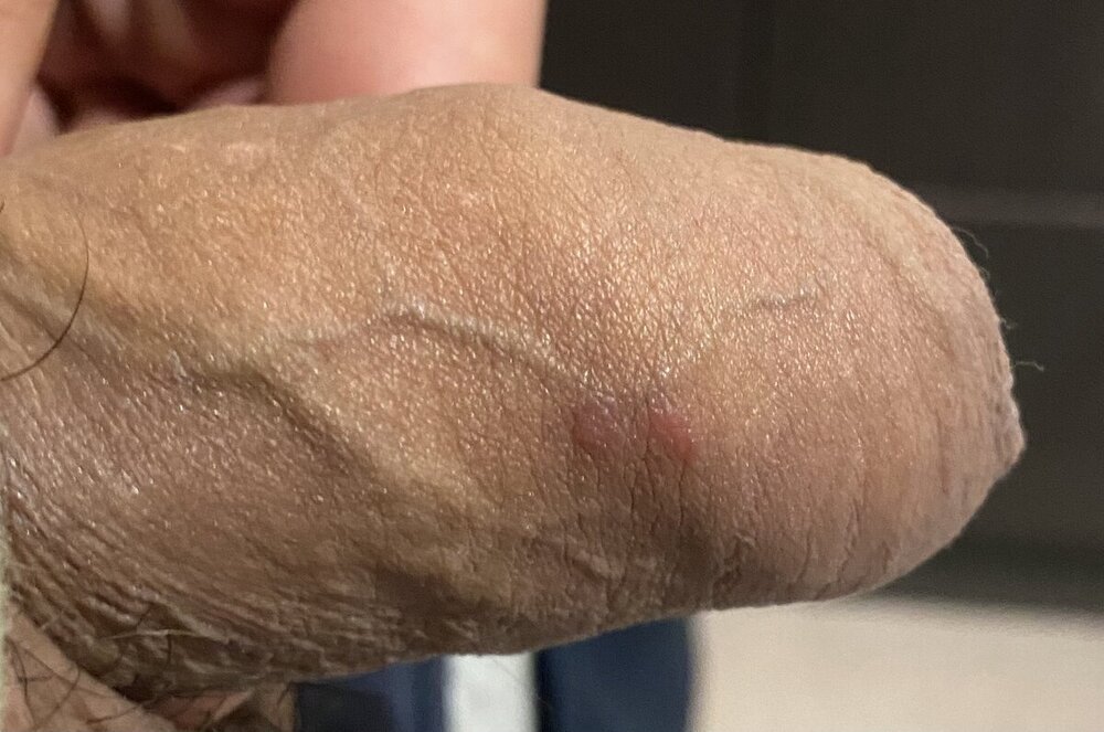 IMG_6612.thumb.jpeg.8259f713a3903f75e96a628e2b2d0f4d.jpeg