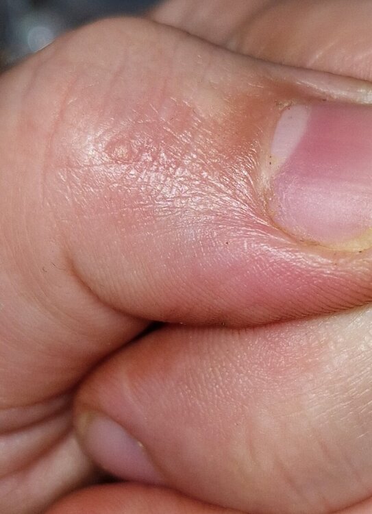 Screenshot_20240417_205314_Gallery.thumb.jpg.329b321cc0c2ced1020ae0aaef3b11a6.jpg