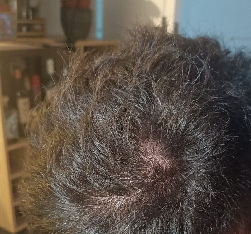 capelli.jpg