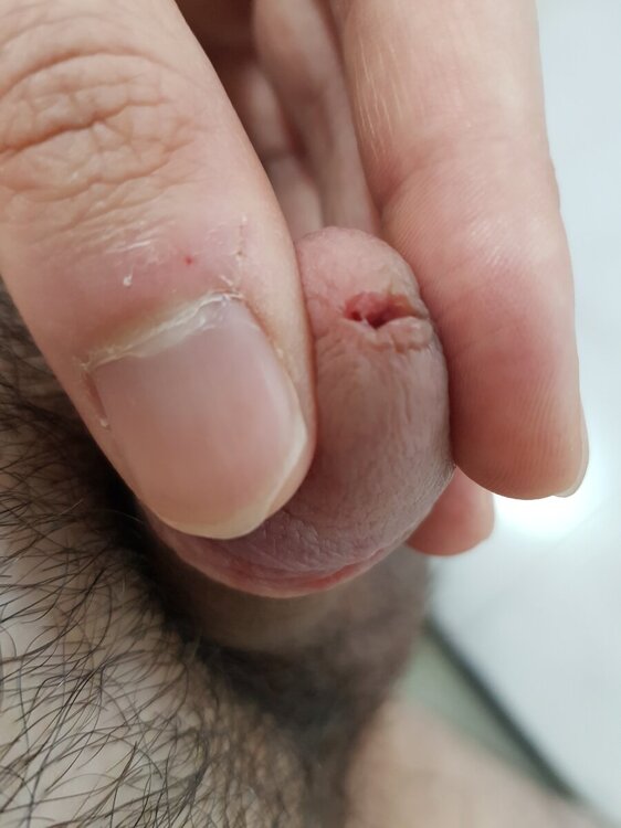 17159408001767616777146001560414.thumb.jpg.c4aa9de3ded3fd391ebba0ab37b29436.jpg