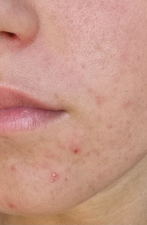 20240503_090952.jpg