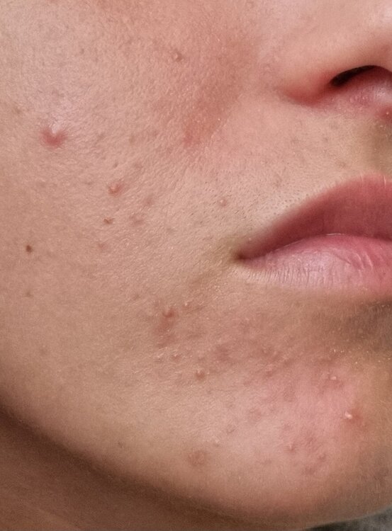 20240506_115551.jpg