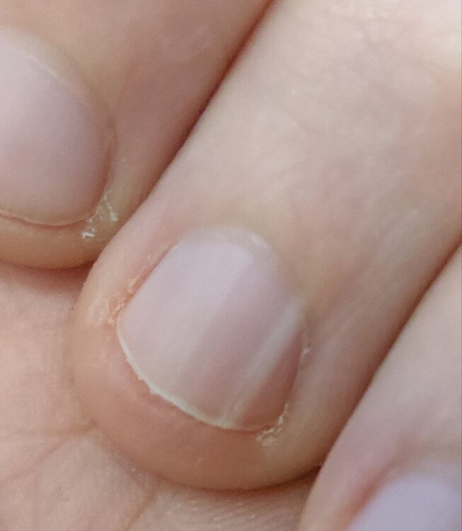 unghia.thumb.jpg.6d64039a43715397f1b89a1fae1d2bcd.jpg