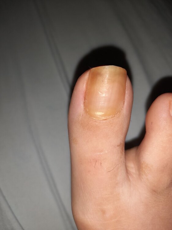 171931059369530421780301172248.thumb.jpg.904a84f31d0c428ad7eeedb9bac8abdd.jpg