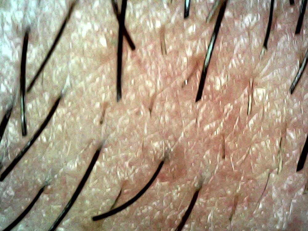 Barba4.thumb.jpg.17cfcfa9c39a42ff82a1d62857376016.jpg
