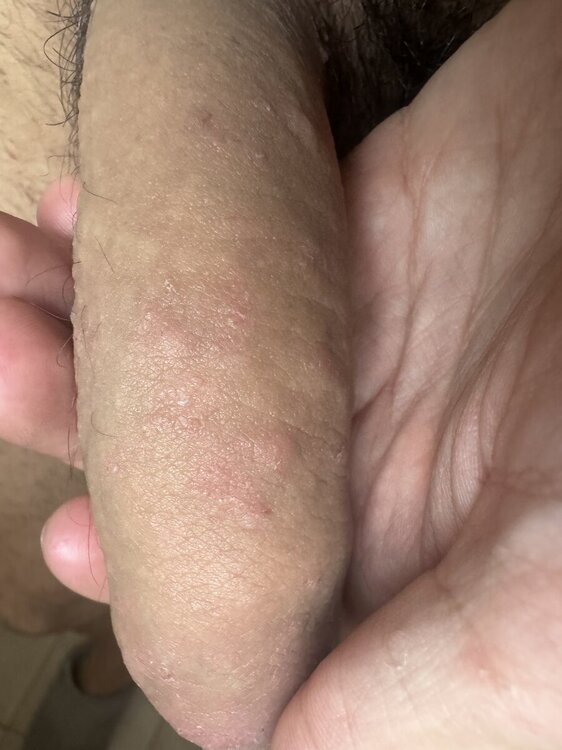 IMG_5487.thumb.jpeg.7f9f22520a6801999aeb59fbf82ee9cc.jpeg