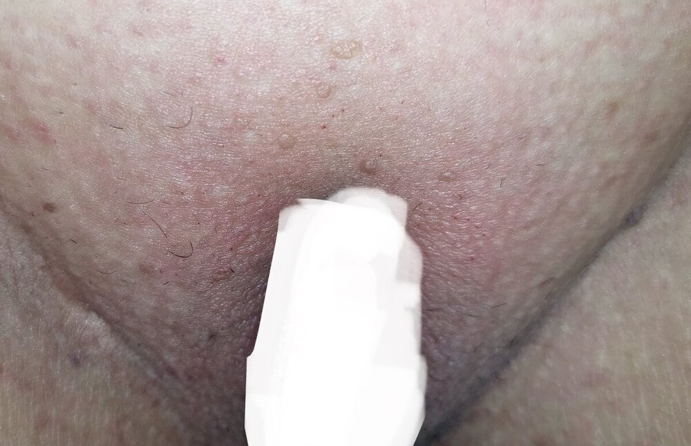 be9154bd-2a81-44f5-b0a5-f50ed3d96cc0.thumb.jpeg.4d67f1321c013c915065de05569dea98.jpeg