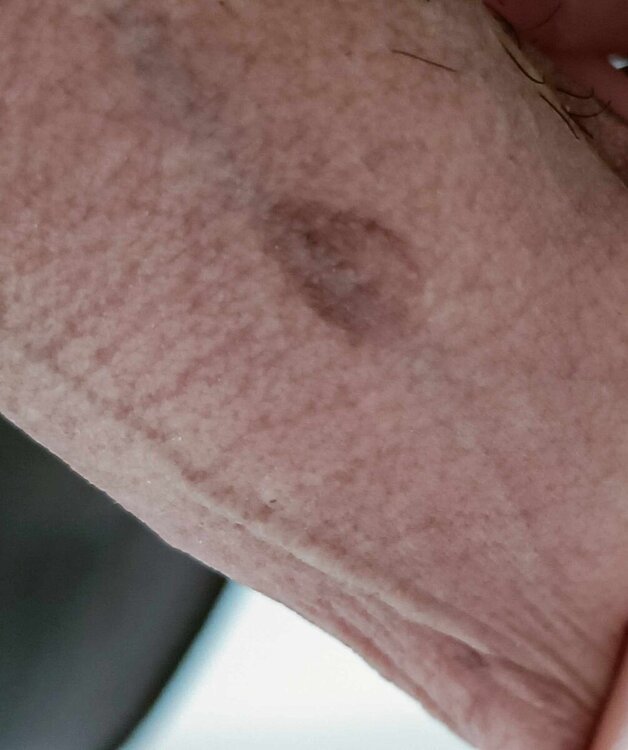 derma.jpg