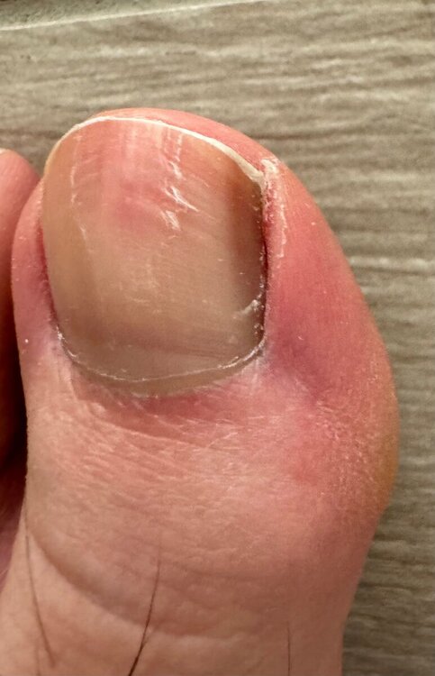piede.thumb.jpeg.648523c21facdf40cfaa1846d358f7b7.jpeg