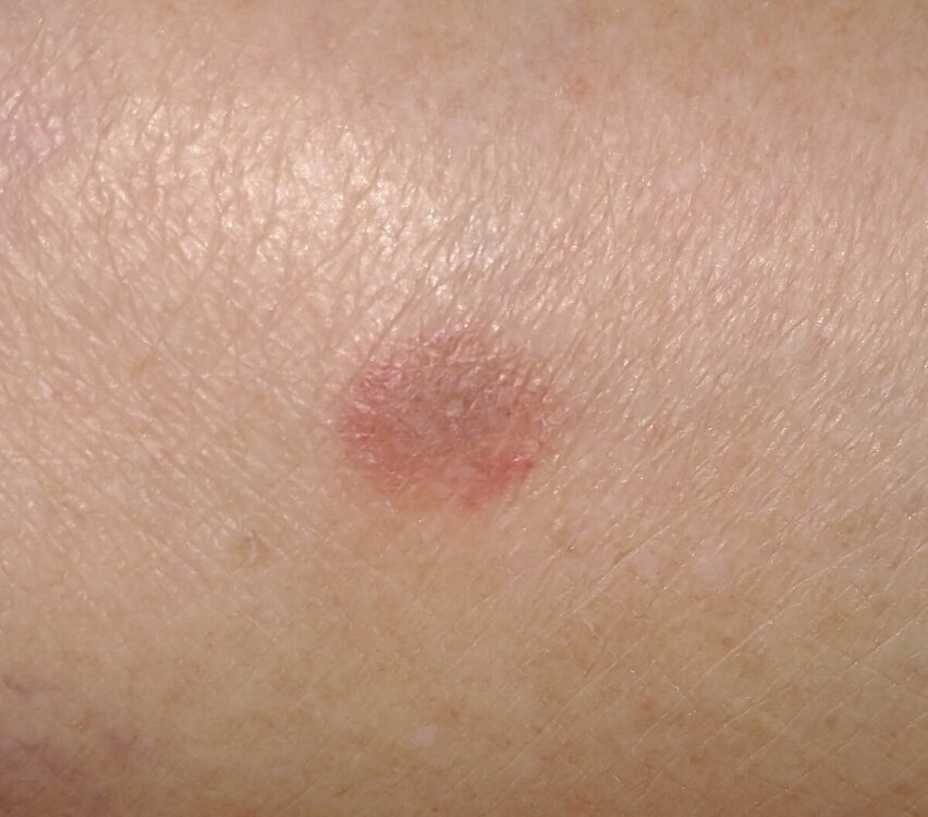 05_07.thumb.jpg.88428316aa7449ebd1dbbe635bfc225a.jpg