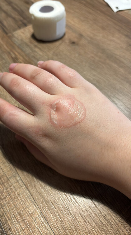 08B7A724-3940-4790-B55C-F13FBD678002.thumb.jpeg.16a6065dd443e15b14cfb970b7610341.jpeg