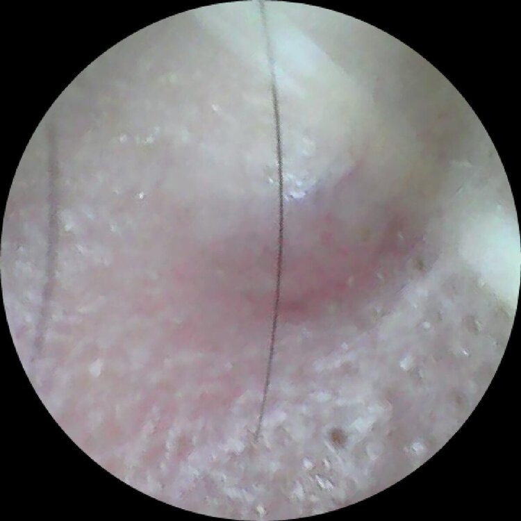 ORECCHIO DX 1.jpg