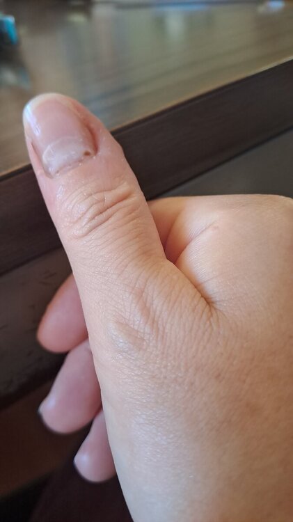 20240715_124043.thumb.jpg.3c27dac9c9f7584ecd3932e5c4f84a01.jpg