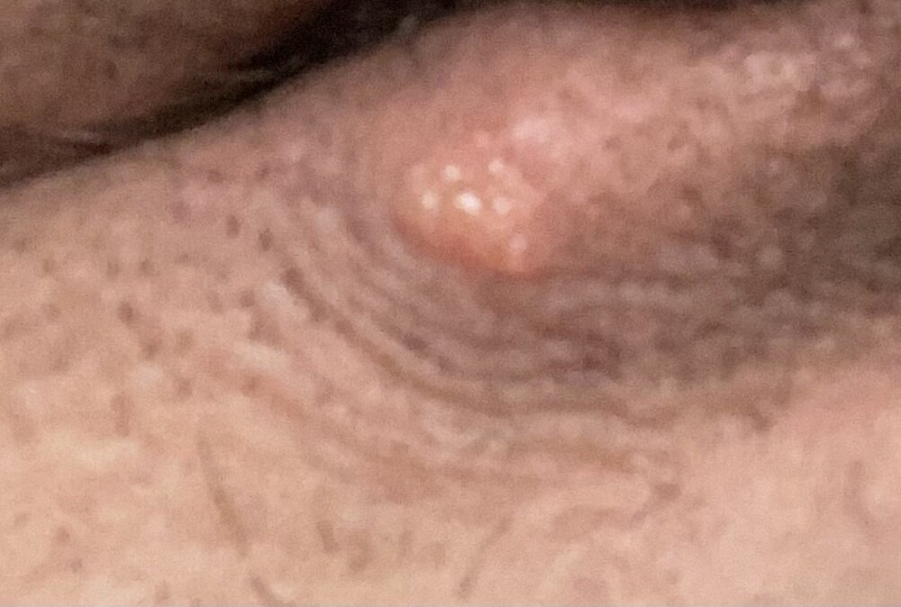 IMG_0592.jpeg