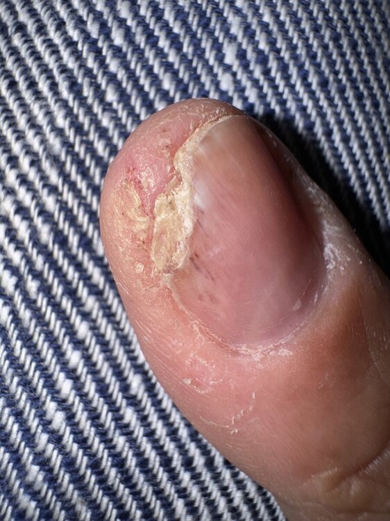 IMG_4053.thumb.jpeg.9ad90c9cfeb9eec8948cb5f288f29a6b.jpeg
