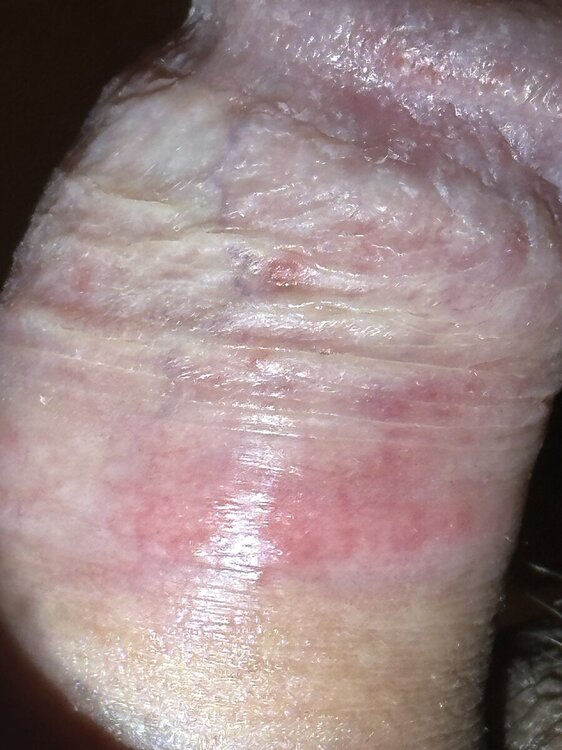 IMG_6240.thumb.jpeg.36b318c7f6bfb6551b943c6144558476.jpeg