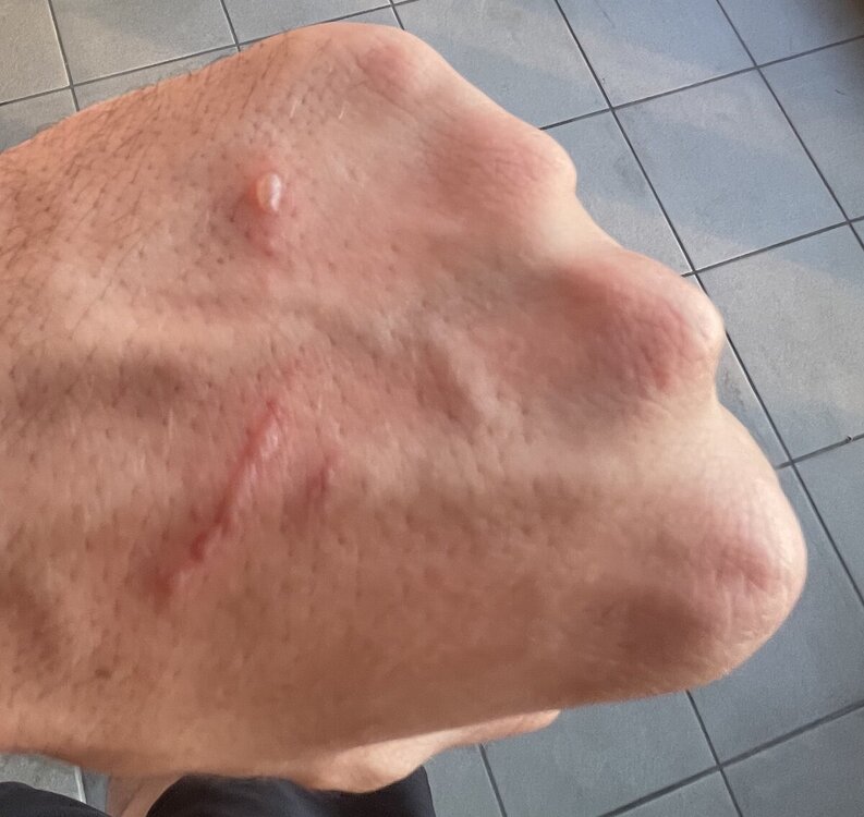 bolle_mano.jpg