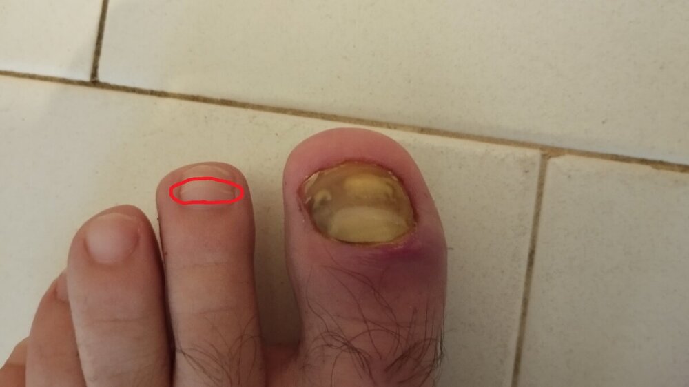 1.thumb.jpg.627fd5e4ccbdee38700c8145add2d65b.jpg
