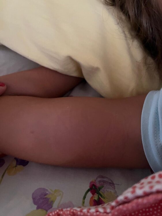 MACCHIA AVAMBRACCIO.jpeg