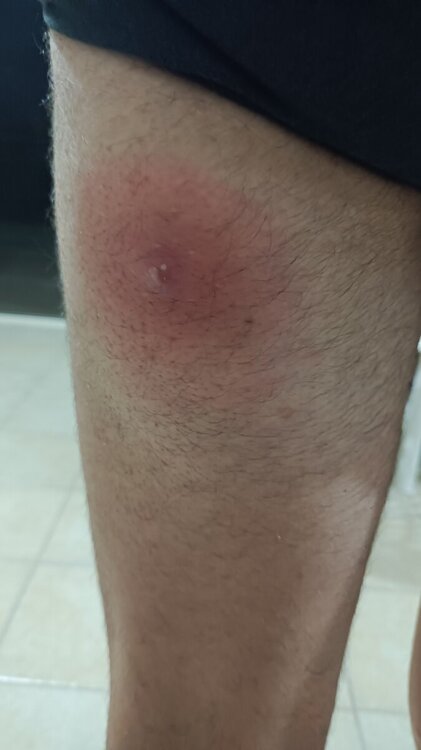 IMG-20240808-WA0022.thumb.jpeg.909466f0d212effd27096815f6789d32.jpeg