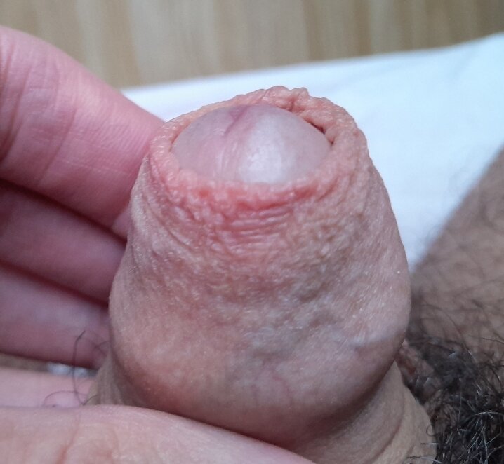 pene 1.jpg