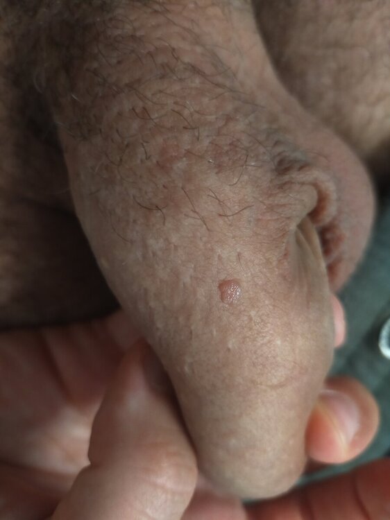 1725288421738946698383976791137.thumb.jpg.51ff2e6c1e48a627f71e4e0099ea3710.jpg