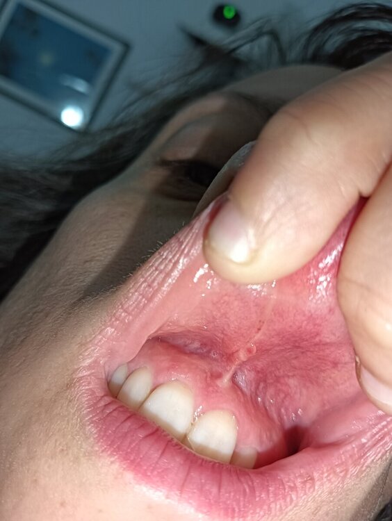 17262922988474348307333724542438.thumb.jpg.f17185d4aff1084356c8c77f1295b716.jpg