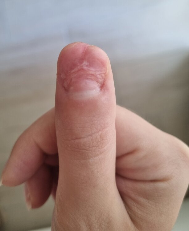 20240921_134710.thumb.jpg.033a1fb02f32969dc62f92ee1f8dd6e8.jpg