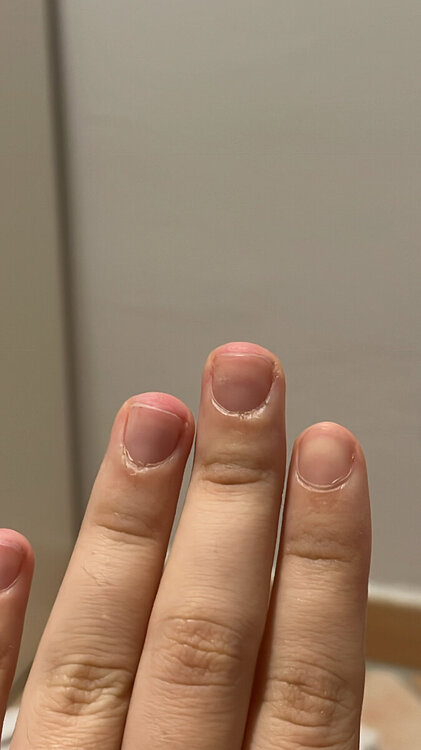 8B934DB4-0578-4467-A1D2-DD132FF3A090.thumb.jpeg.3008805351e0c3e07b0c40be891a6b61.jpeg
