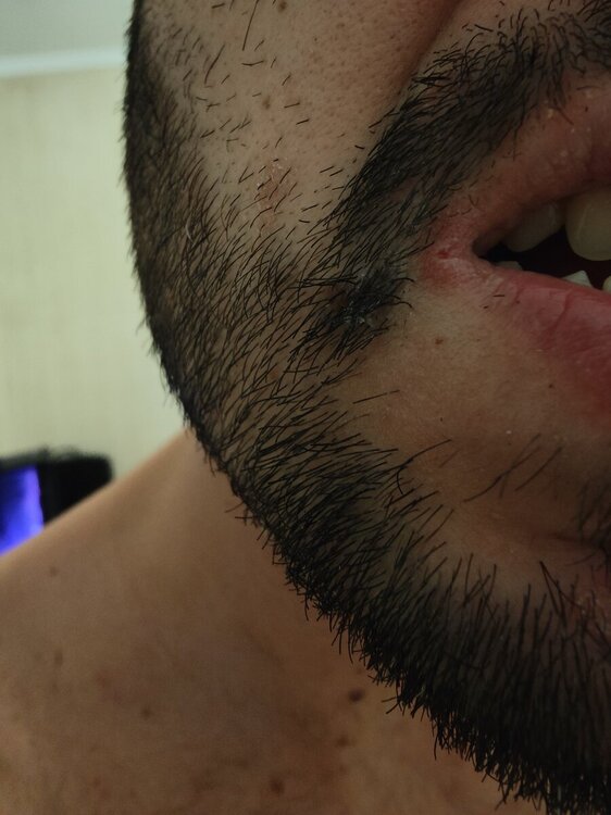 IMG20240904214141.jpg