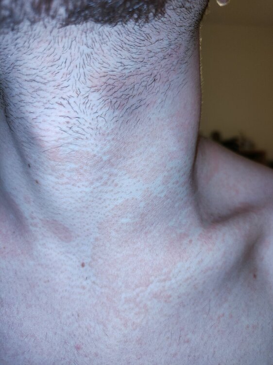 IMG20240908192200.jpg