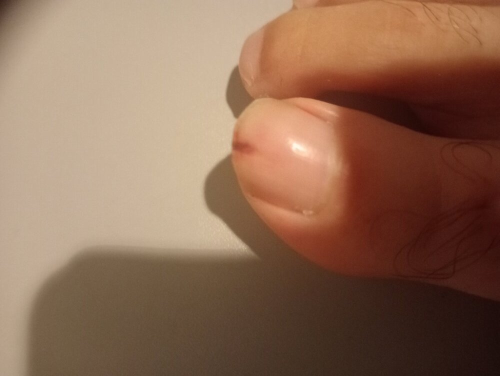 IMG20240923092223.thumb.jpg.9d2e05eb8a9d7cfd0a226d9f1e5e4034.jpg
