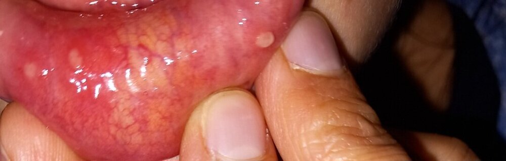 Screenshot_20240907_161804_Gallery.thumb.jpg.221a4981bc325d5e4428f6f88ba9a707.jpg
