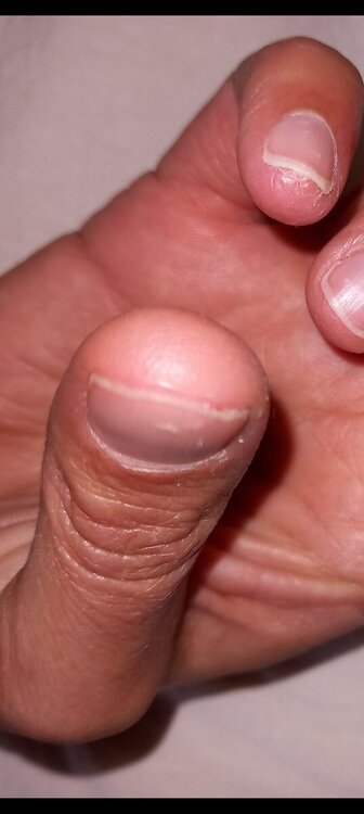 Screenshot_20240907_163553_Gallery.thumb.jpg.3f37ed4ead0c4e0bd6d2942158bae9ab.jpg
