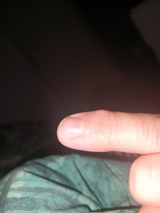 17291993274925618475142328766355.thumb.jpg.c61f23b2cda98f676be0ca56e76dabfe.jpg