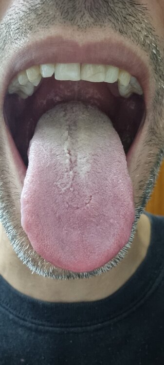 20241029_191810.jpg