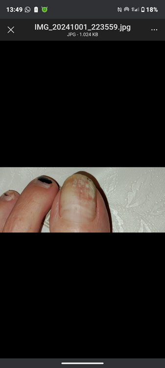 Screenshot_20241005-134938.thumb.png.c848e45a15cc1485d2e3a73f7be08646.png
