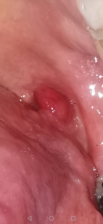 Screenshot_20241013_001805_com.android.gallery3d.thumb.jpg.a4d942e4c7a5fe6140d0b69eb0c42d98.jpg